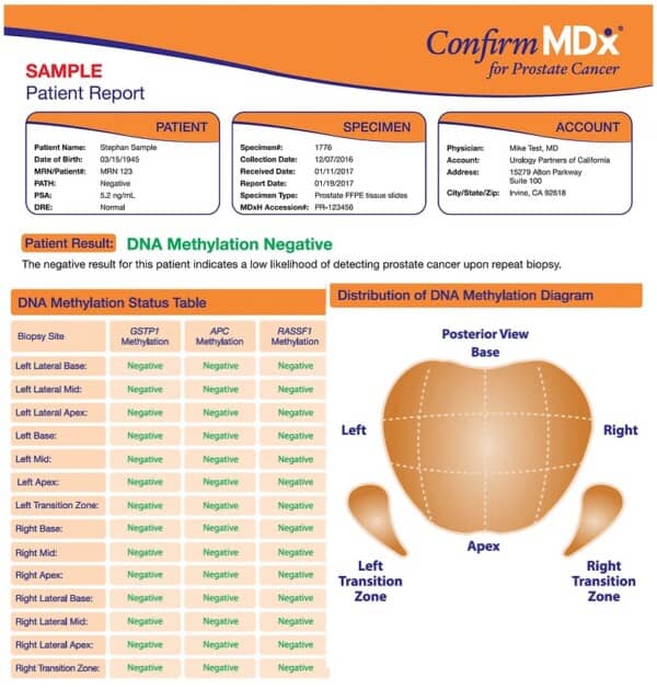 Image of a confirm mdx negative test result.