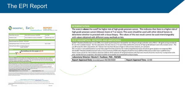 ExoDx Test Result Image.