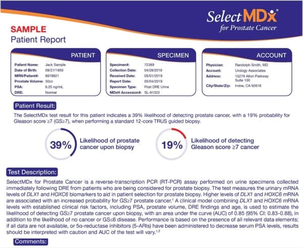 The positive results for a SelectMDx test shown in this image.