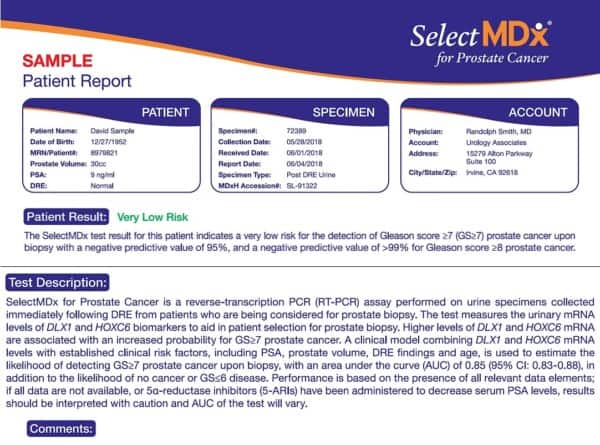 Image of a negative result from Select MDx Test.