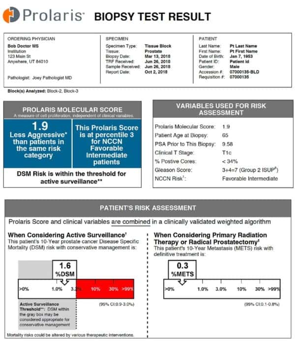 Image of Prolaris Test Results.