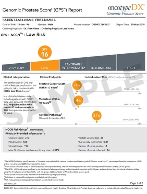 OncotypeDx Results PC Markers OncotypeDx Results PC Markers